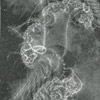 Persistent Vegetative